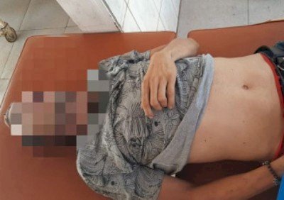 Corpo de homem deixado em frente hospital da fronteira é identificado