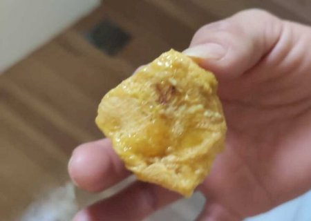 Menino passa mal e pais descobrem que ele engoliu gaze em Ceim