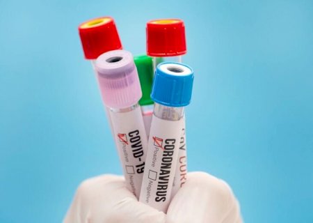 MS registra seis mortes e mais de mil casos de covid em uma semana