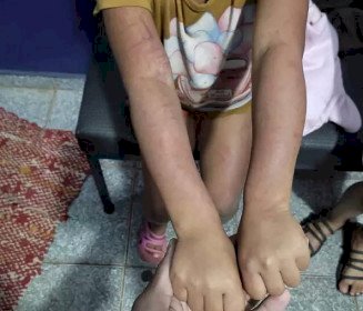 Mãe e padrasto são presos por torturar crianças de 4 e 6 anos