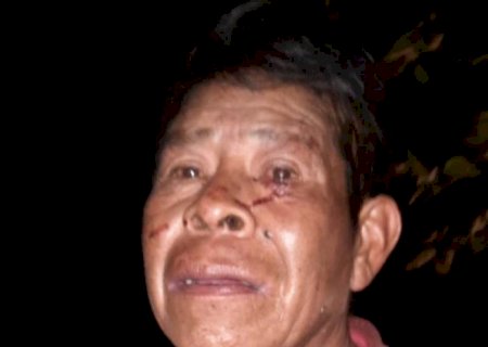 Homem mata mulher queimada em comunidade rural da fronteira