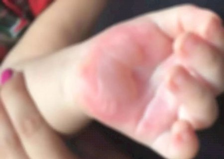 Criança de 4 Anos é Socorrida   em Estado Grave e Mãe Presa Por Tortura