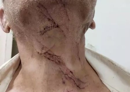 Adolescente esfaqueia avô de namorada para 'dar lição' no idoso