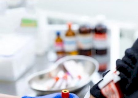 Diabetes tipo 2: sintomas e a importância do exame de glicose no sangue