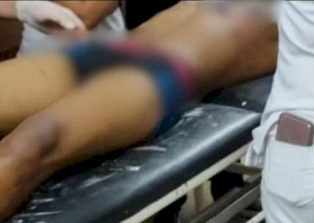 Venezuelano é esfaqueado no tórax na fronteira de MS