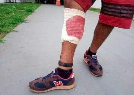 Homem Viaja Para Passar Réveillon na Casa do Irmão e Acaba Ferido por Bala Perdida