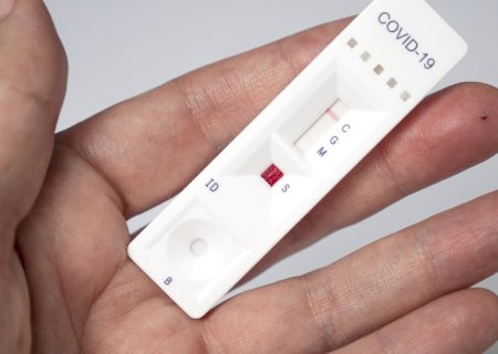 MS confirma 6 mortes e mais de 400 casos de Covid-19, segundo boletim da SES