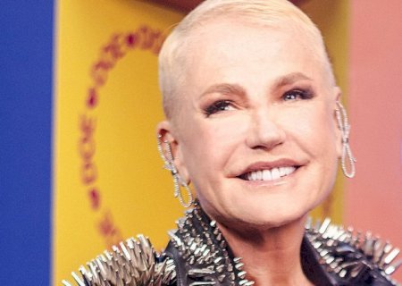Xuxa passa por procedimento estético cirúrgico e revela o motivo