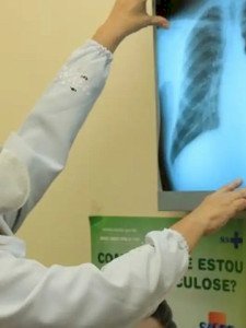 Com 192 casos em 2024, Dourados intensifica ações para combater tuberculose