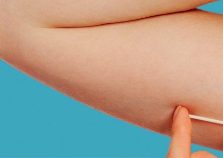 HU realiza mutirão com DIU e Implanon, mas atendimento seguirá critérios médicos