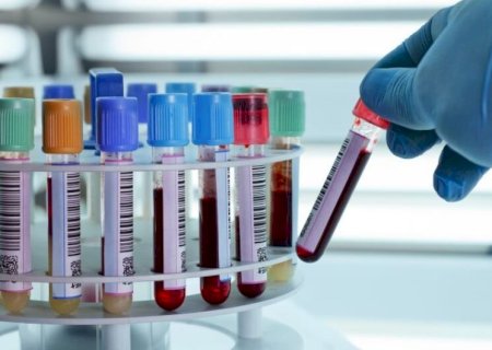 Lei determina que empresas divulguem campanhas de conscientização sobre vacinas, HPV e câncer