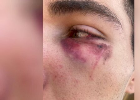 Em minutos, entregador é espancado e tem moto roubada no Pioneiros (vídeo)