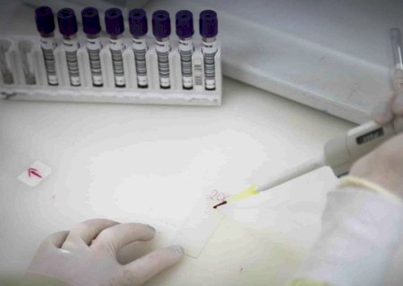 Secretaria de Saúde de SP investiga novo caso suspeito de ebola