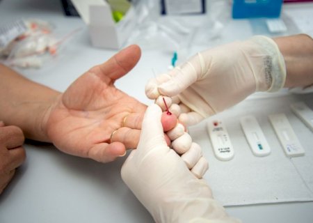 Prefeitura realiza mais de 2 mil testes e não registra novos casos de hepatite B em 2026